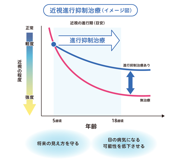近視進行抑制治療の目的