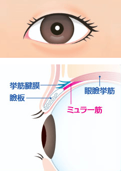 眼瞼下垂ではない目